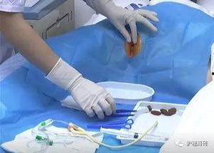 女病人导尿操作视频,女性病人护理实践详解