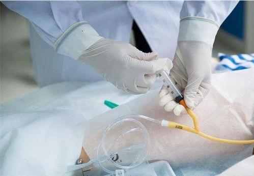 插尿管的视频,一图看懂插尿管操作步骤