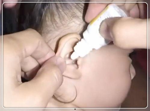 掏耳屎的视频,轻松掌握清洁耳朵小技巧